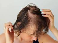 Hair Mesotherapy and Hair Booster scalp injection treatment at Rida Radiance Hyderabad