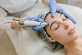 RF Microneedling