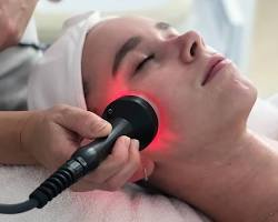 Radiofrequency