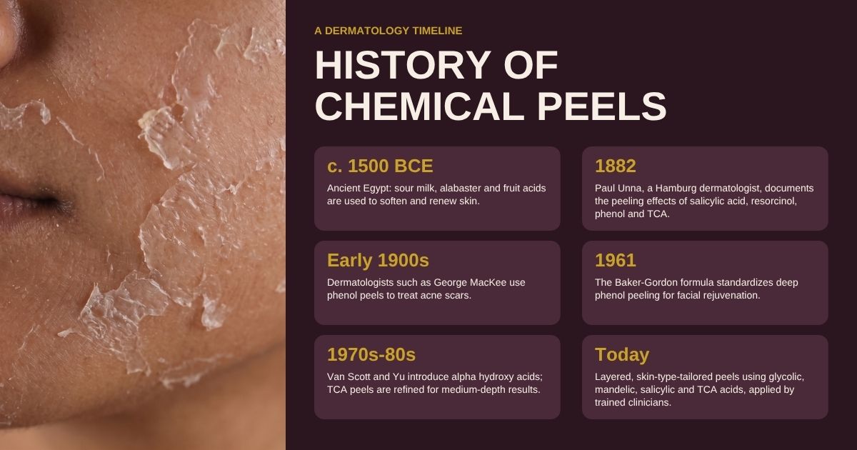 History of chemical peels timeline and chemical peel treatment in Hyderabad at Rida Radiance, Gachibowli